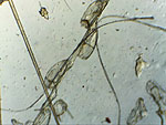mikroskopowa diagnostyka weterynaryjna-jaja wszy na włosach szczura